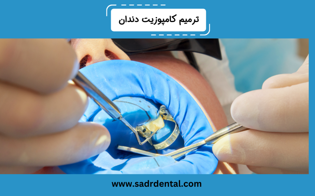 ترمیم کامپوزیت دندان قدیمی، دندانهای جلو و عقب