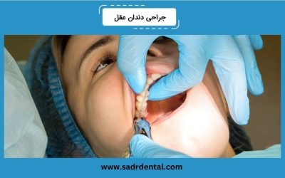 جراحی دندان عقل چیست؟ دلایل انجام، هزینه و مراقبتهای لازم