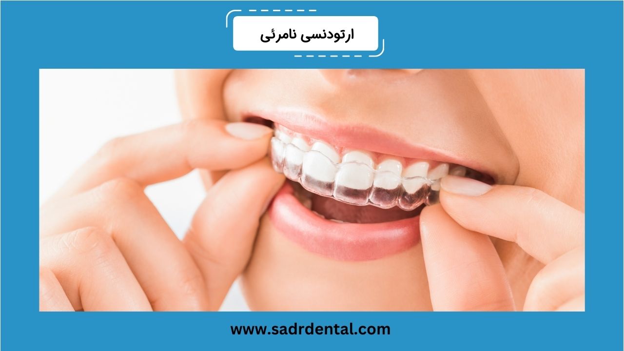 ارتودنسی نامرئی