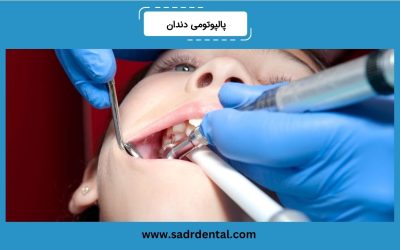 پالپوتومی دندان چیست؟ مراحل و مراقبتهای پس از درمان