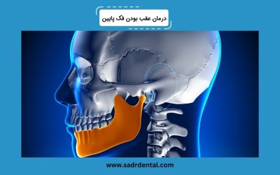 درباره درمان عقب بودن فک پایین بیشتر بدانید