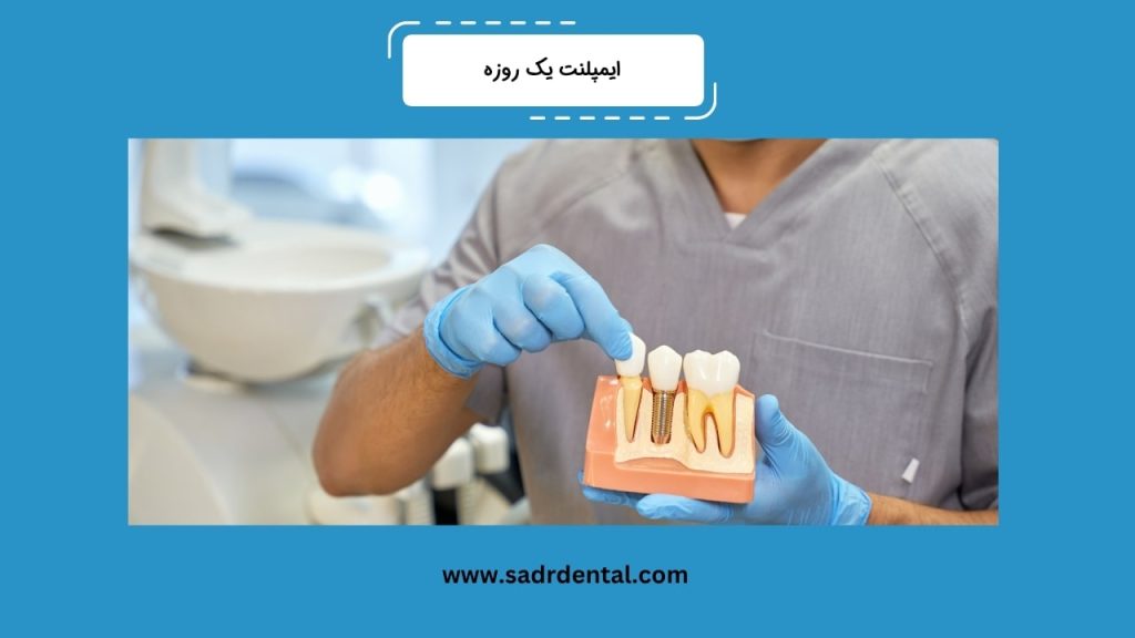 ایمپلنت یک روزه