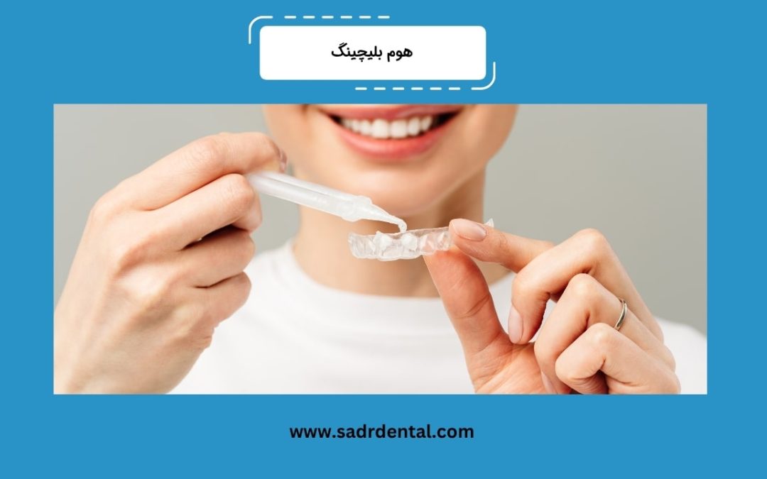 هوم بلیچینگ چیست؟ مزایا، معایب و مراحل انجام