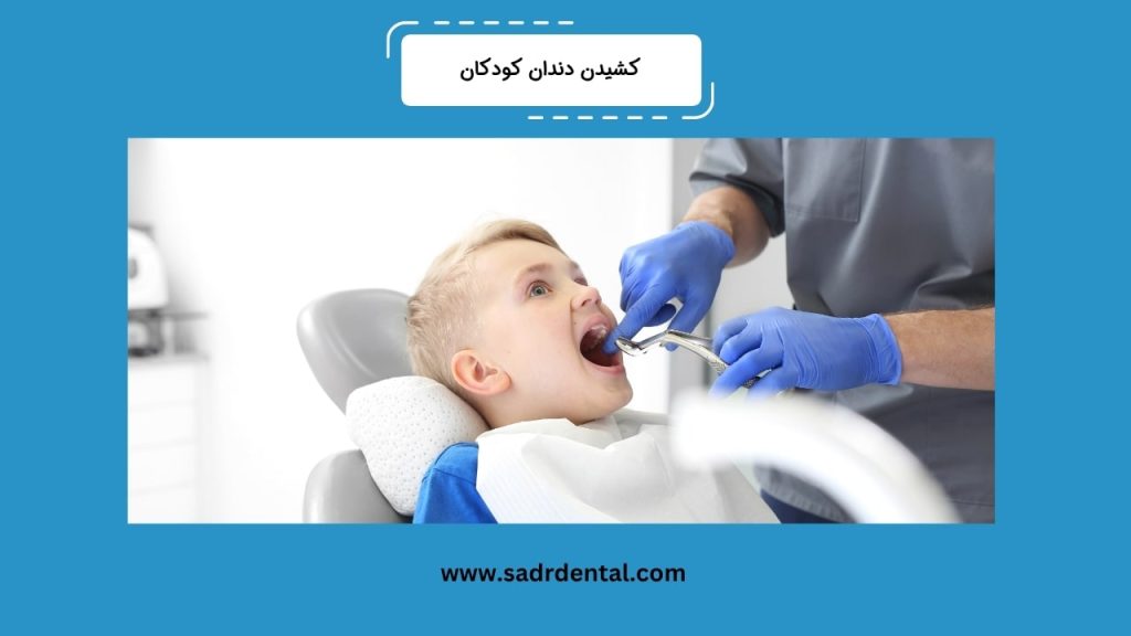کشیدن دندان کودکان